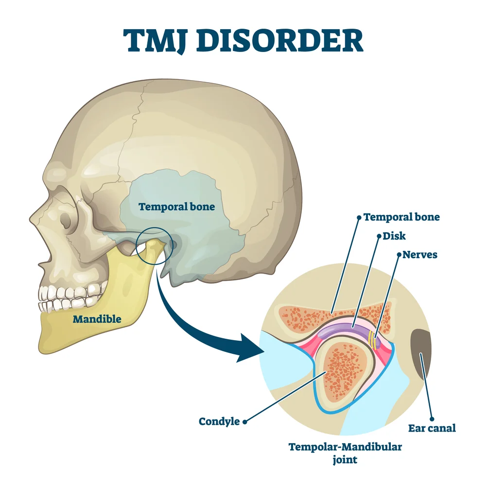 TMJ Anatomy My Jaw Click